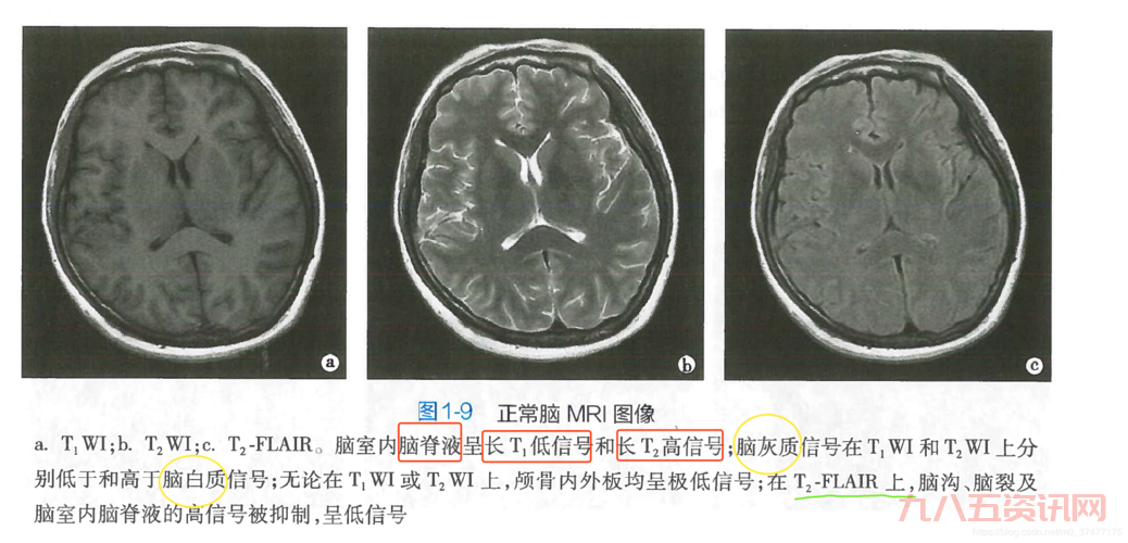 什么是伪t2信号?这篇文章让你秒懂!